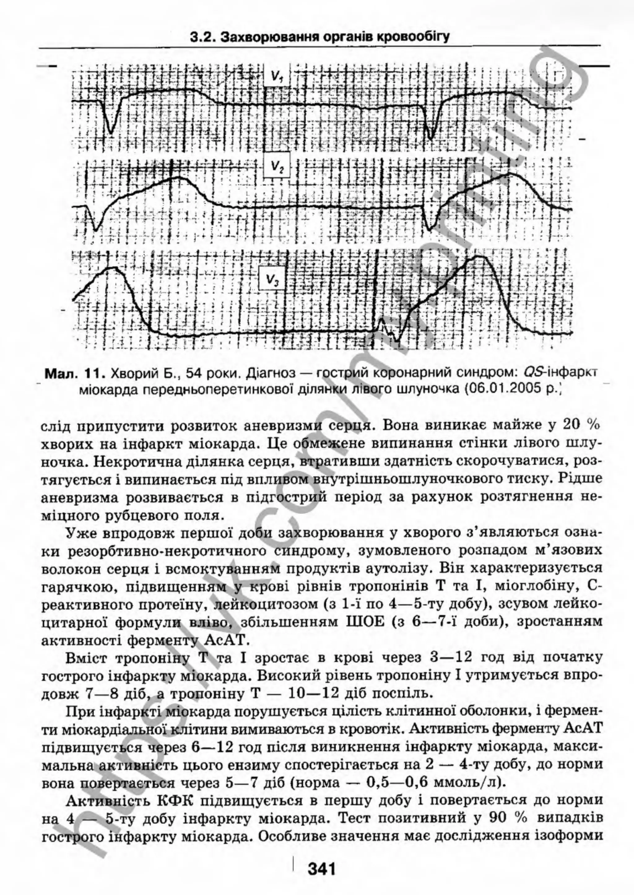 внутрішня медицина, терапія  н. м. середюк, о. с. стасишин, і. п. вакалюк –  медици, 2013. – 686 http://vk.com/my.printing