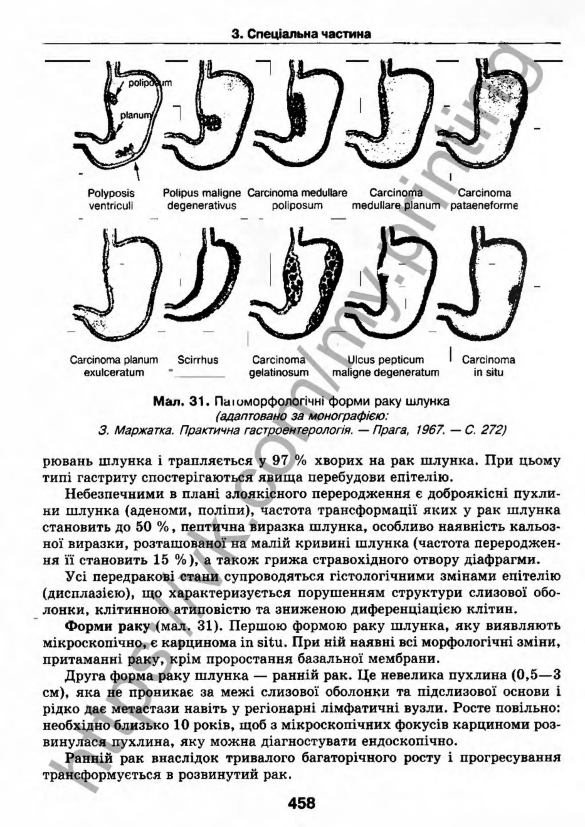 внутрішня медицина, терапія  н. м. середюк, о. с. стасишин, і. п. вакалюк –  медици, 2013. – 686 http://vk.com/my.printing