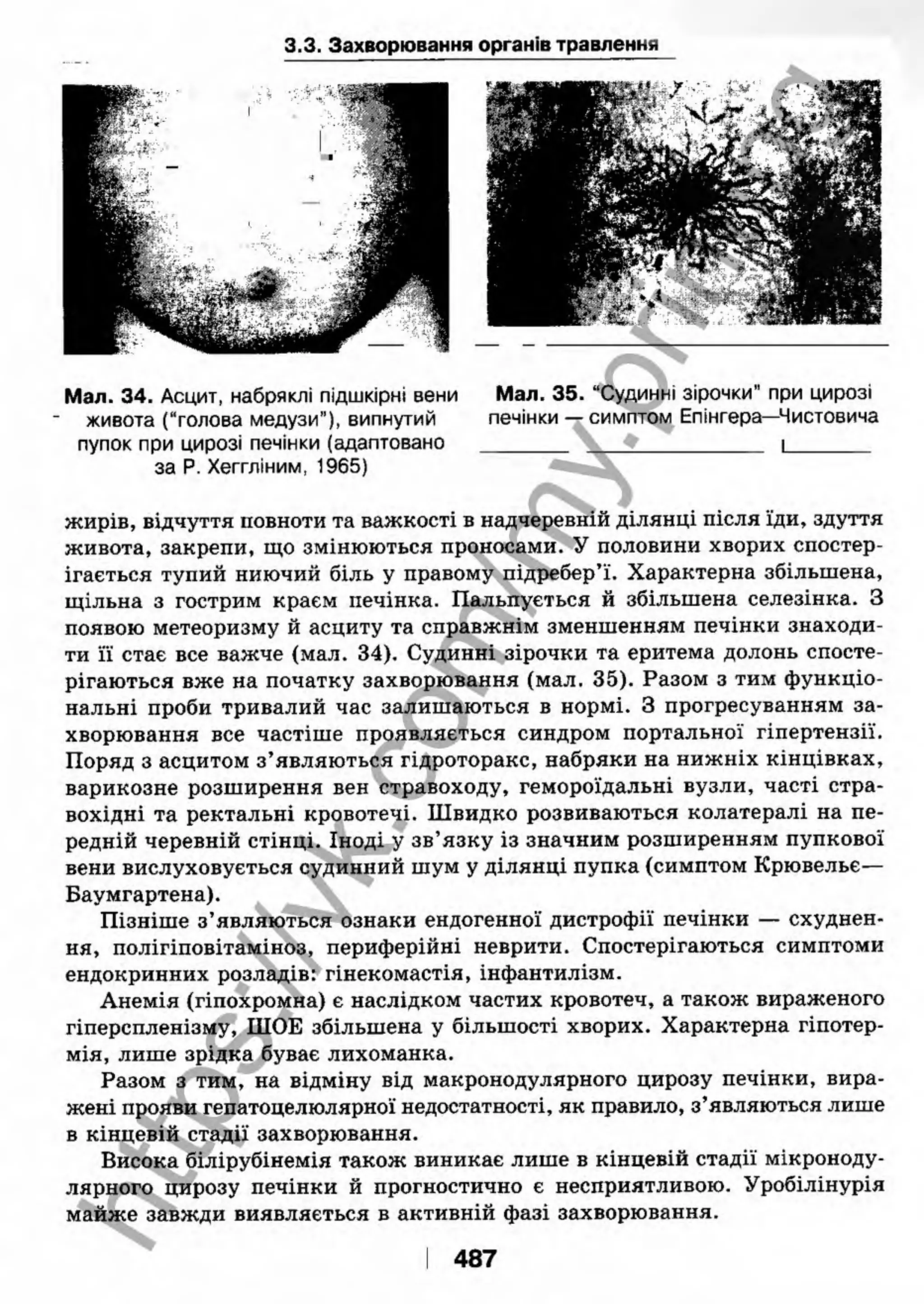 внутрішня медицина, терапія  н. м. середюк, о. с. стасишин, і. п. вакалюк –  медици, 2013. – 686 http://vk.com/my.printing