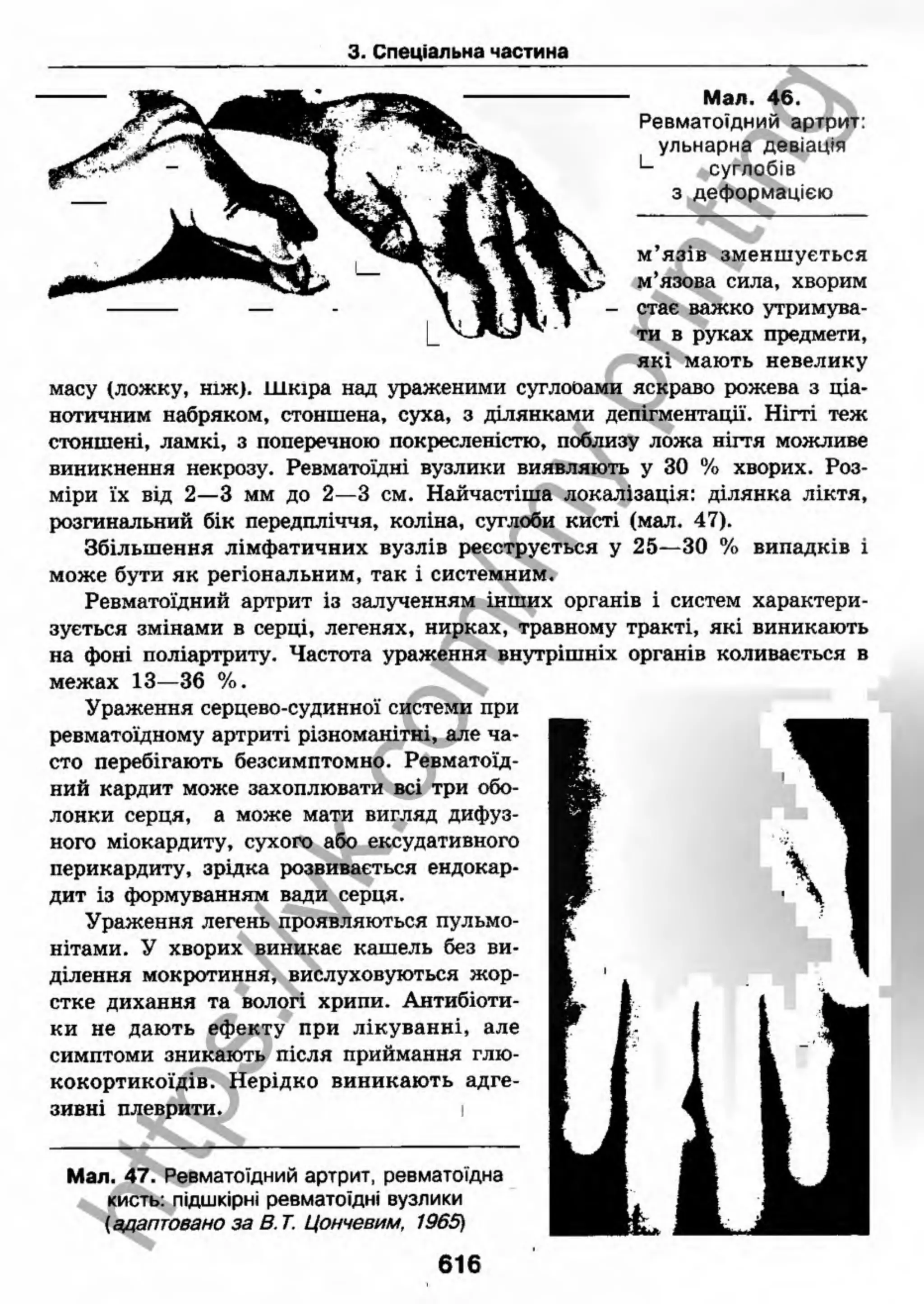 внутрішня медицина, терапія  н. м. середюк, о. с. стасишин, і. п. вакалюк –  медици, 2013. – 686 http://vk.com/my.printing