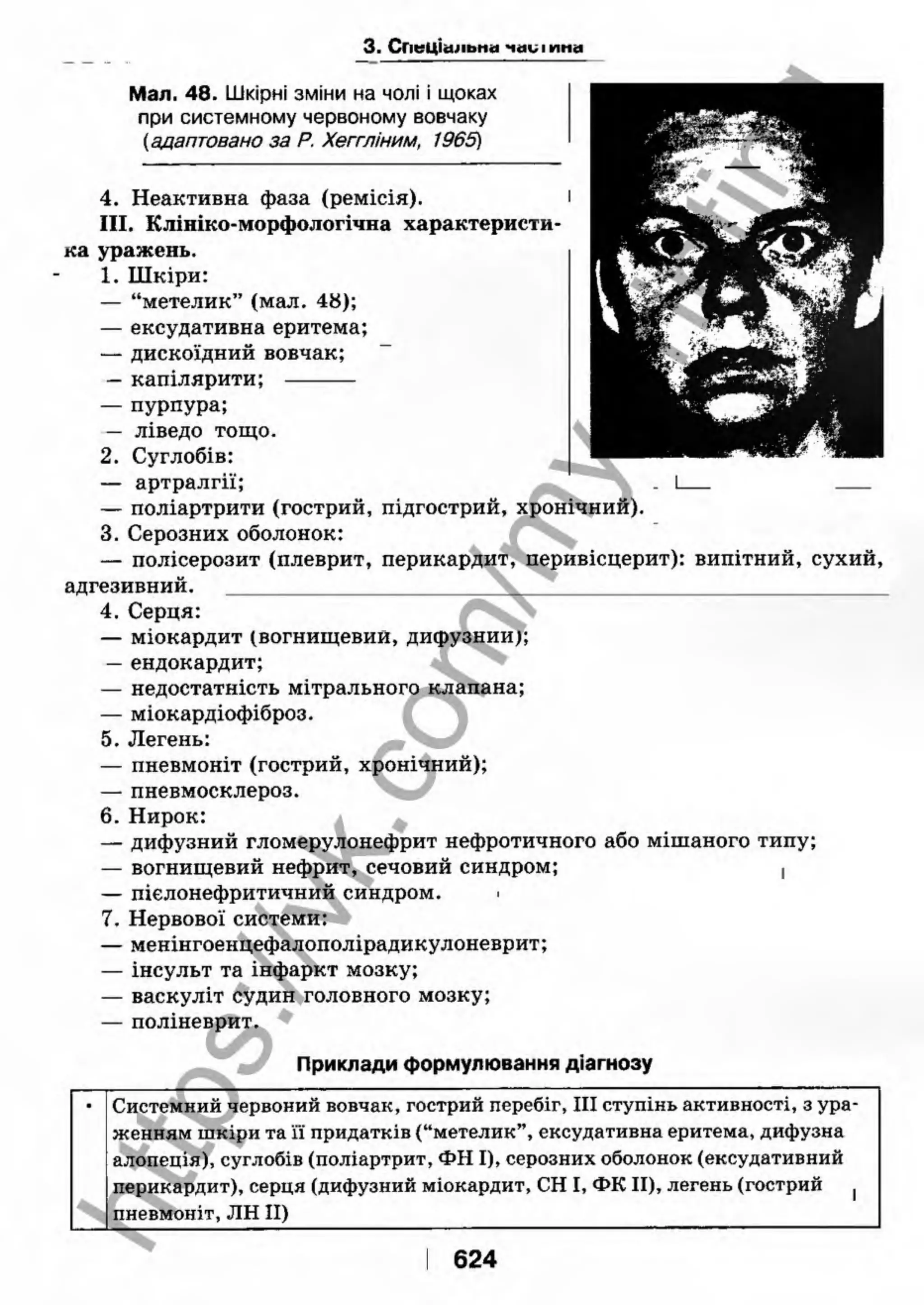 внутрішня медицина, терапія  н. м. середюк, о. с. стасишин, і. п. вакалюк –  медици, 2013. – 686 http://vk.com/my.printing