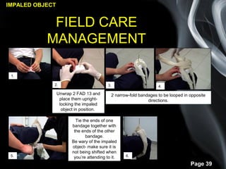 2.2.3 soft tissue injuries | PPT