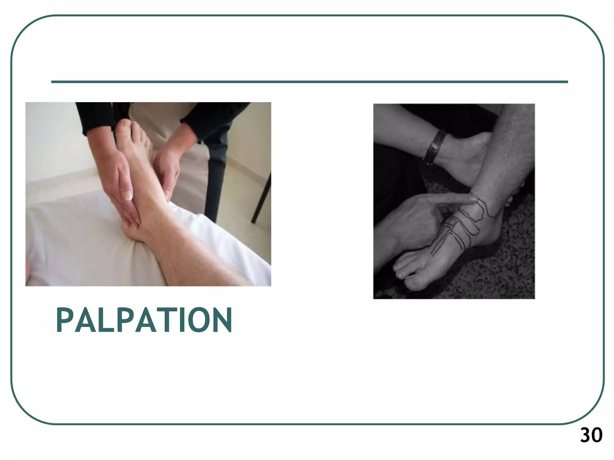 PALPATION
30
 