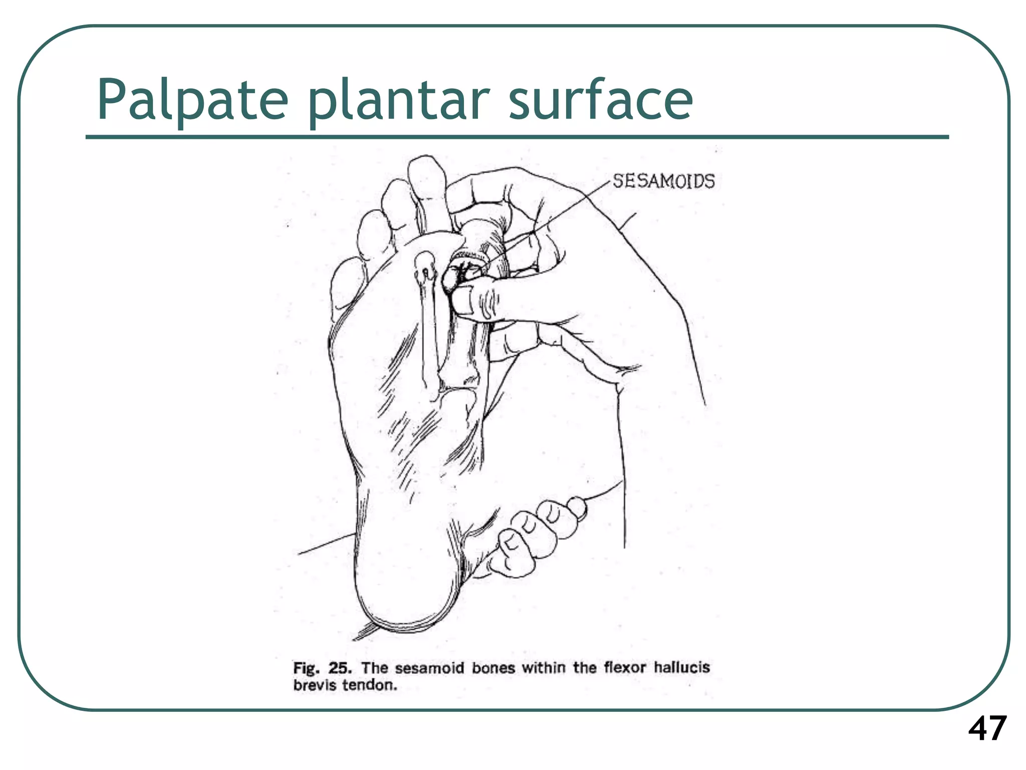 Palpate plantar surface
47
 