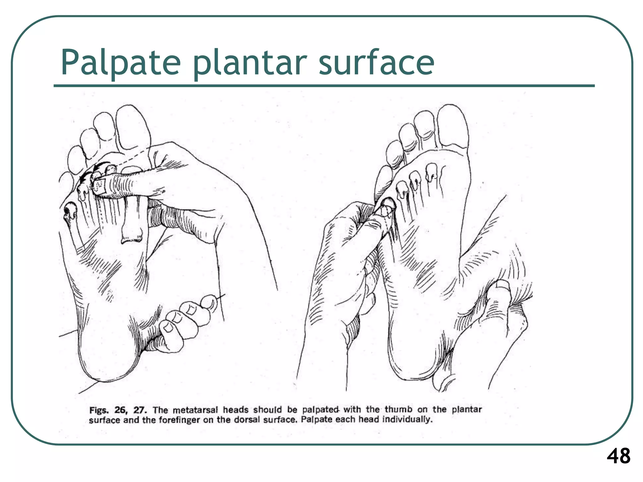 Palpate plantar surface
48
 