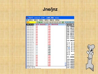 Jne/jnz
 