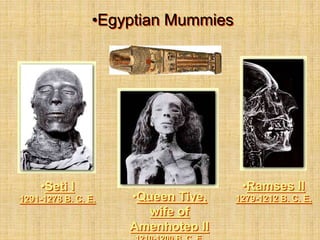 •Egyptian Mummies
•Seti I
1291-1278 B. C. E. •Queen Tiye,
wife of
Amenhotep II
•Ramses II
1279-1212 B. C. E.
 