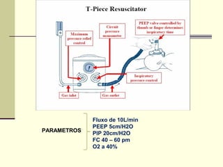 PARAMETROS
Fluxo de 10L/min
PEEP 5cm/H2O
PIP 20cm/H2O
FC 40 – 60 pm
O2 a 40%
 