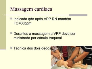 Massagem cardíaca
 Indicada qdo após VPP RN mantém
FC<60bpm
 Durantes a massagem a VPP deve ser
ministrada por cânula traqueal
 Técnica dos dois dedos
 