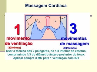 Massagem Cardiaca
 