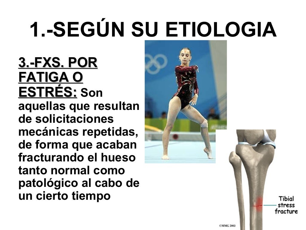 2. trastornos y lesiones del sistema musculoesqueletico