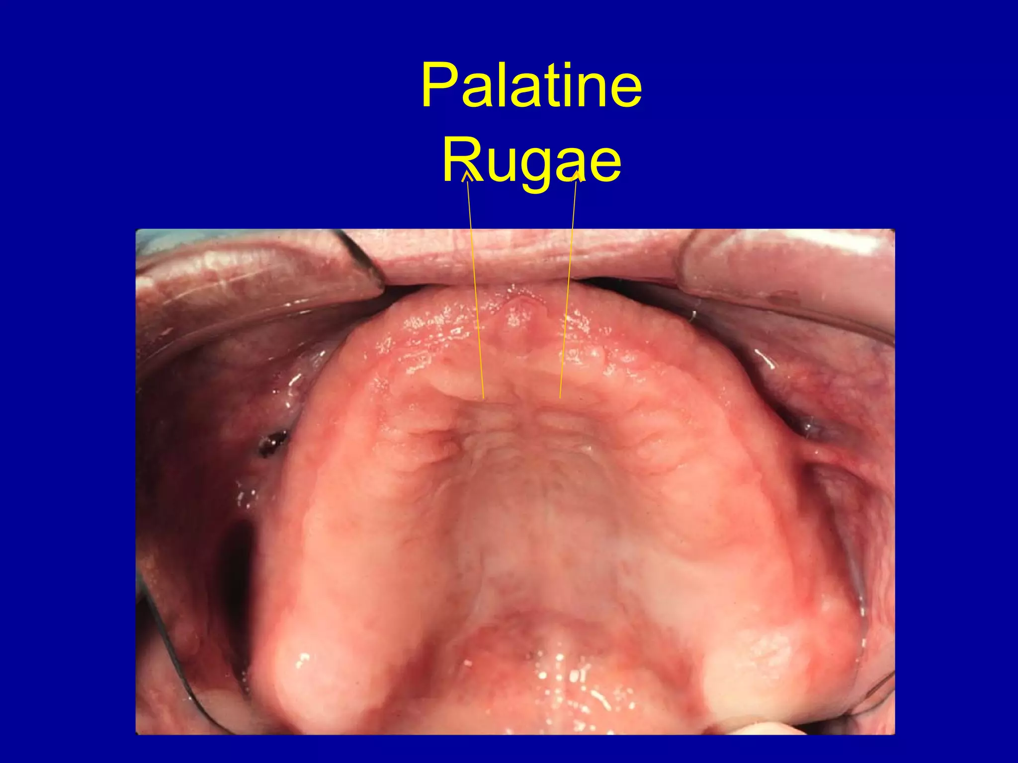 oral anatomy | PPT