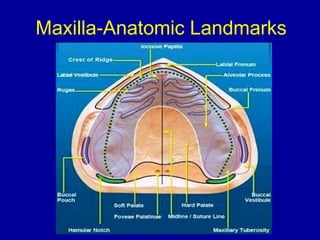 Maxilla-Anatomic Landmarks
 