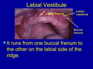 Labial frenum
Labial
vestibule
Buccal
frenum
Labial Vestibule
 It runs from one buccal frenum to
the other on the labial side of the
ridge.
 