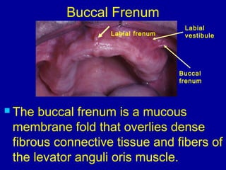 Labial frenum
Labial
vestibule
Buccal
frenum
Buccal Frenum
 The buccal frenum is a mucous
membrane fold that overlies dense
fibrous connective tissue and fibers of
the levator anguli oris muscle.
 