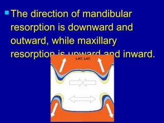  The direction of mandibular
resorption is downward and
outward, while maxillary
resorption is upward and inward.
 
