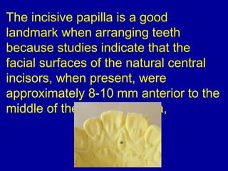 The incisive papilla is a good
landmark when arranging teeth
because studies indicate that the
facial surfaces of the natural central
incisors, when present, were
approximately 8-10 mm anterior to the
middle of the incisive papilla,
 