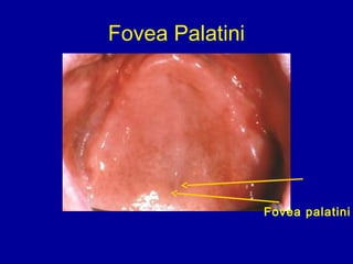Fovea Palatini
Fovea palatini
 