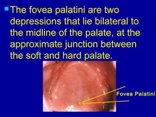  The fovea palatini are two
depressions that lie bilateral to
the midline of the palate, at the
approximate junction between
the soft and hard palate.
Fovea Palatini
 