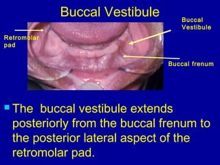 Buccal
Vestibule
Buccal Vestibule
 The buccal vestibule extends
posteriorly from the buccal frenum to
the posterior lateral aspect of the
retromolar pad.
Buccal frenum
Retromolar
pad
 