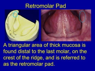 A triangular area of thick mucosa is
found distal to the last molar, on the
crest of the ridge, and is referred to
as the retromolar pad.
Retromolar Pad
 