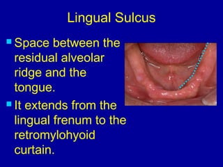 Lingual Sulcus
 Space between the
residual alveolar
ridge and the
tongue.
 It extends from the
lingual frenum to the
retromylohyoid
curtain.
 