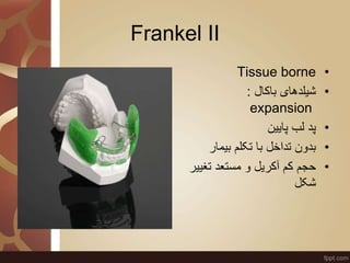 Frankel II
•Tissue borne
•‫باکال‬ ‫شیلدهای‬:
expansion
•‫پایین‬ ‫لب‬ ‫پد‬
•‫بیمار‬ ‫تکلم‬ ‫با‬ ‫تداخل‬ ‫بدون‬
•‫تغی‬ ‫مستع...