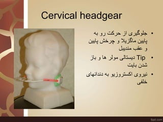 Cervical headgear
•‫به‬ ‫رو‬ ‫حرکت‬ ‫از‬ ‫جلوگیری‬
‫پای‬ ‫چرخش‬ ‫و‬ ‫ماگزیال‬ ‫پایین‬‫ین‬
‫مندیبل‬ ‫عقب‬ ‫و‬
•Tip‫باز‬ ‫و‬...