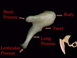 Anterior Crus
Foot Plate
Head
Neck
Posterior Crus
 