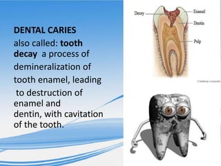 DENTAL CARIES
also called: tooth
decay a process of
demineralization of
tooth enamel, leading
to destruction of
enamel and
dentin, with cavitation
of the tooth.
 
