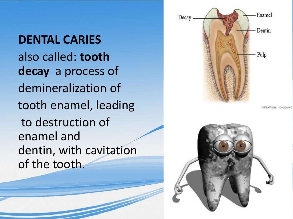 DENTAL PLAQUE & CARIES