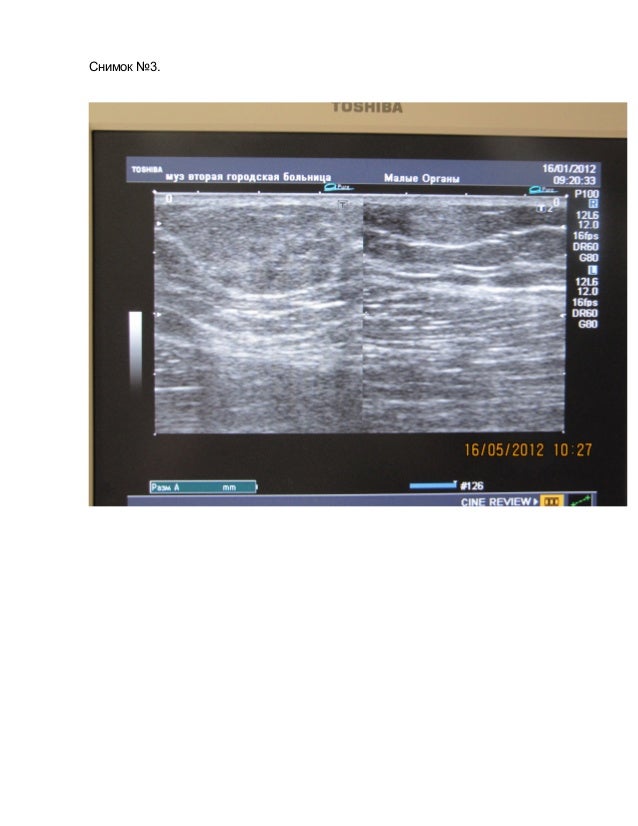 Ультразвуковые