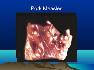 Pork MeaslesPork Measles
 