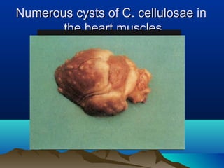 Numerous cysts of C. cellulosae inNumerous cysts of C. cellulosae in
the heart musclesthe heart muscles..
 