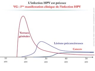 10
ans
30
ans
40
ans
Verrues
génitales
Lésions précancéreuses
L’infection HPV est précoce
VG : 1ère manifestation clinique de l’infection HPV
20
ans
50
ans
Cancers
SanofiPasteurMSD-FR00827-FRAN000000092–13/07/69604608/PM/001–juillet2013
 