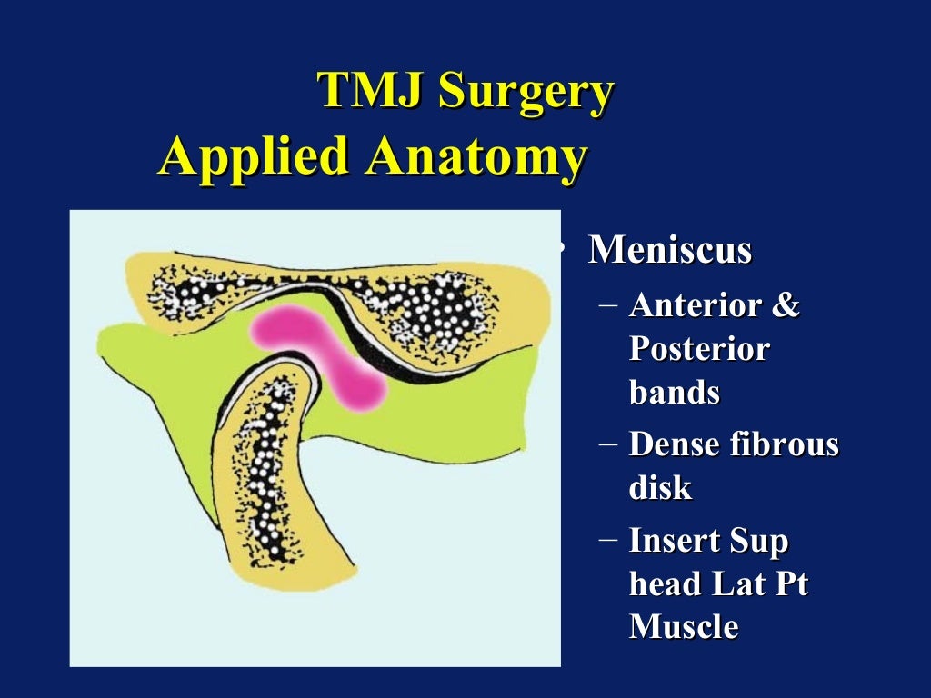 overview tmj surgery / dental courses