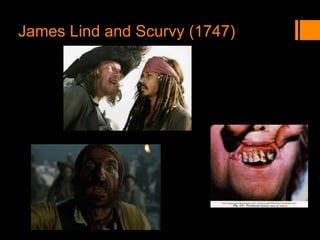 James Lind and Scurvy (1747)
 