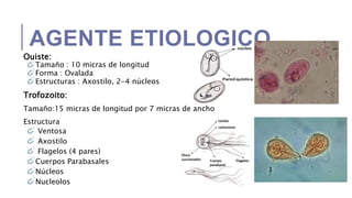 Giardiasis | PPTX