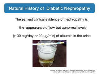 The earliest clinical evidence of nephropathy is
the appearance of low but abnormal levels 

(≥ 30 mg/day or 20 μg/min) of albumin in the urine.
Natural History of Diabetic Nephropathy
Parving, H, Østerby, R & Ritz, E: Diabetic nephropathy, in The Kidney 2000

edited by Brenner BM, Levine S, Philadelphia, W.B. Saunders, p 1731
 