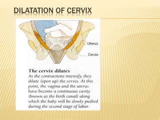 DILATATION OF CERVIX
 