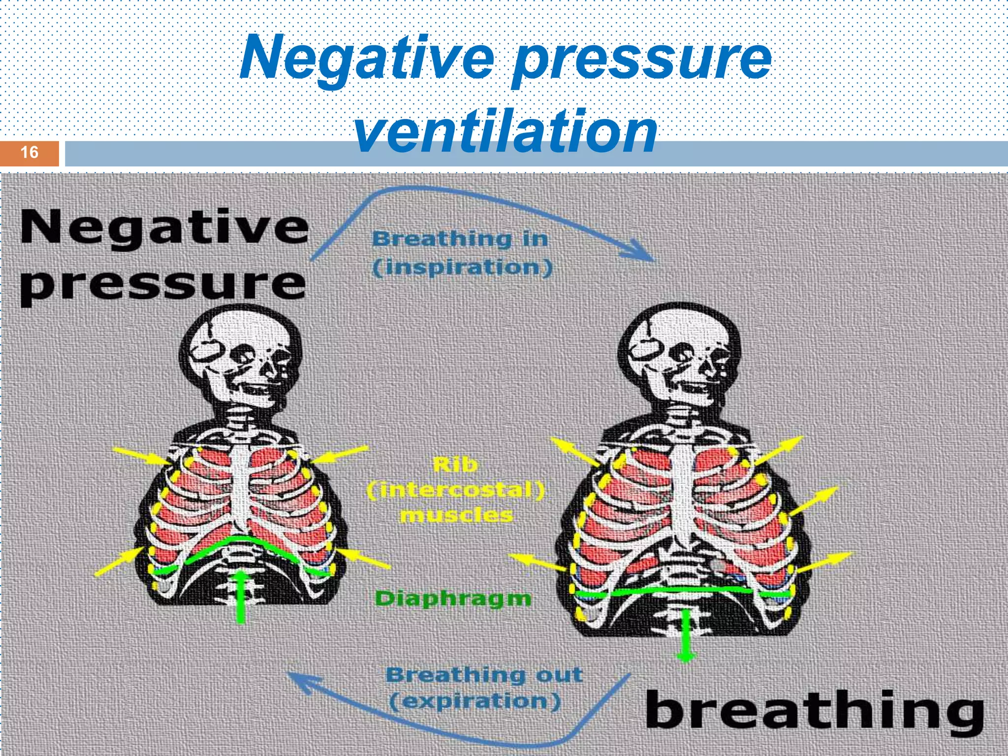Negative pressure
ventilation16
 