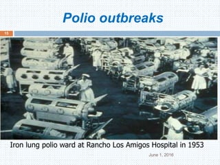 Polio outbreaks
June 1, 2016
15
Iron lung polio ward at Rancho Los Amigos Hospital in 1953
 