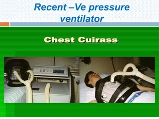 Recent –Ve pressure
ventilator
Hera NICU 2016
 