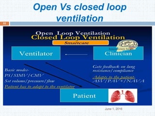 Open Vs closed loop
ventilation
June 1, 2016
22
 