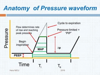 Anatomy of Pressure waveform
Hera NICU 2016
Ti Te
Pressure
Begin
inspiration
Cycle to expiration
Time
Flow determines rate
of rise and reaching
peak pressure
Pressure limited =
“PIP”
PEEP
∆p
MAP
 
