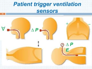 Patient trigger ventilation
sensors
June 1, 2016
41
+ −
∆ P⟇
∆ P
E
 
