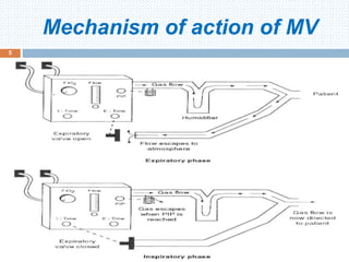 Mechanism of action of MV
5
 