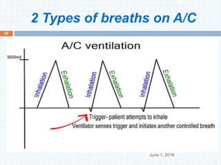 2 Types of breaths on A/C
June 1, 2016
52
 