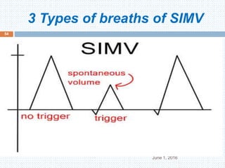 3 Types of breaths of SIMV
June 1, 2016
54
 