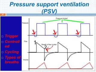 Pressure support ventilation
(PSV)
June 1, 2016
57
 Trigger
 Controll
ed
 Cycling
 Types of
breaths
 